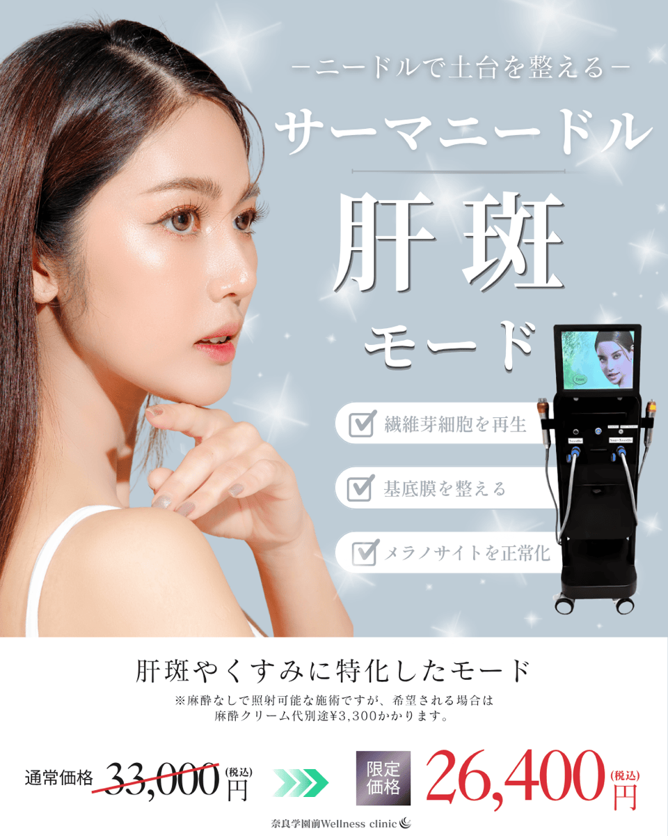 -ニードルで土台を整える- サーマニードル肝斑モード 繊維芽細胞を再生 基底膜を整える メラノサイトを正常化 通常価格33,000円（税込）が限定価格26,400円（税込）。