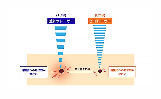 メラニン色素を細かく粉砕し、効率よく排出