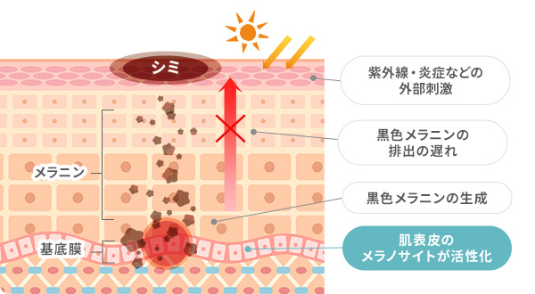 シミができるまでの過程