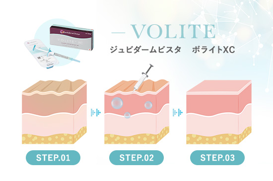 ジュビダームビスタ　ボライトXC